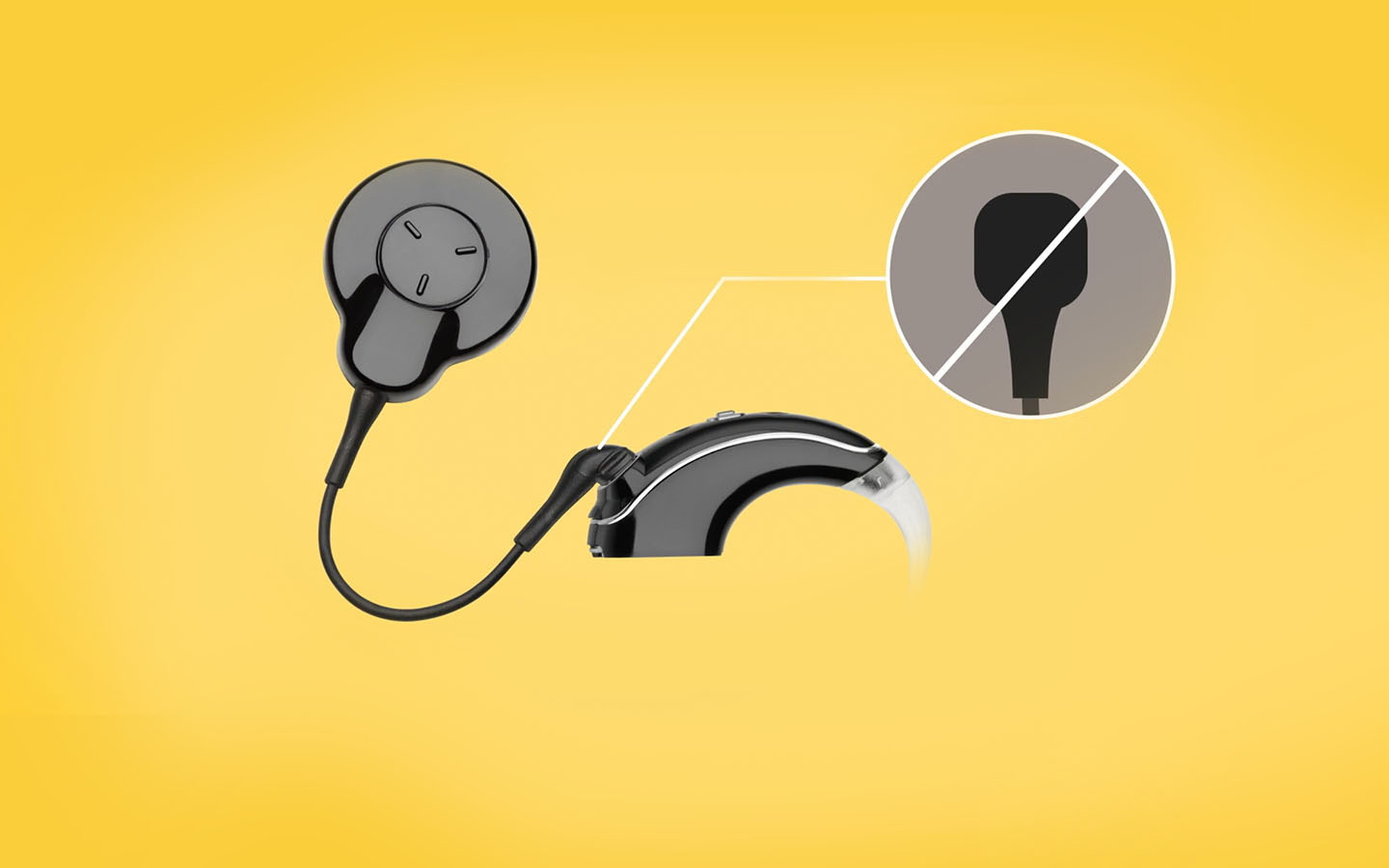 Cochlear Nucleus 7 Hearing Device Support Cochlear